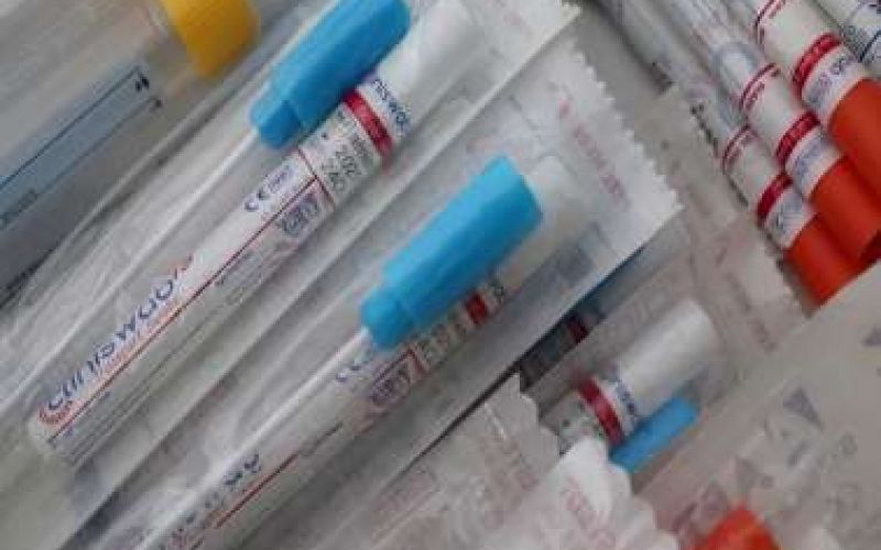 Αυτά είναι τα σημεία για rapid test για την Πέμπτη